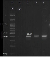 Jundishapur J Microbiol